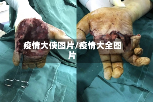 疫情大侠图片/疫情大全图片-第3张图片