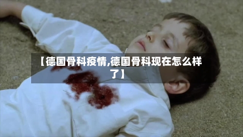 【德国骨科疫情,德国骨科现在怎么样了】-第3张图片