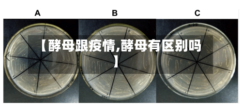 【酵母跟疫情,酵母有区别吗】