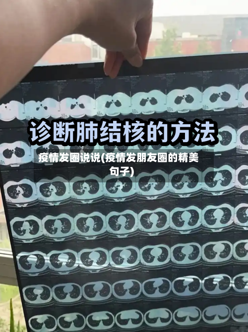 疫情发圈说说(疫情发朋友圈的精美句子)