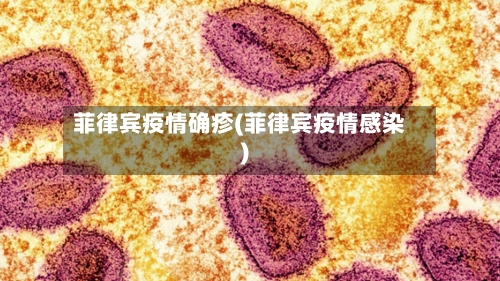 菲律宾疫情确疹(菲律宾疫情感染)