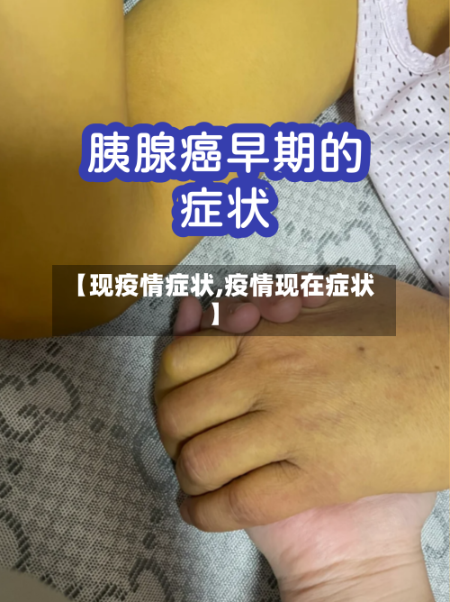【现疫情症状,疫情现在症状】-第3张图片